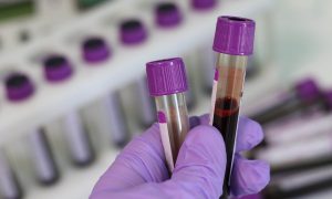 Muž kúpil svojej priateľke na narodeniny sadu na testovanie DNA