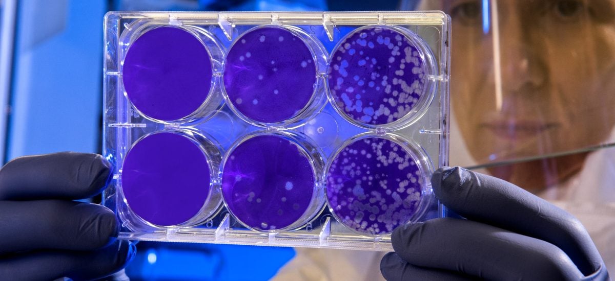 Vedci objavili najväčšiu baktériu na svete
