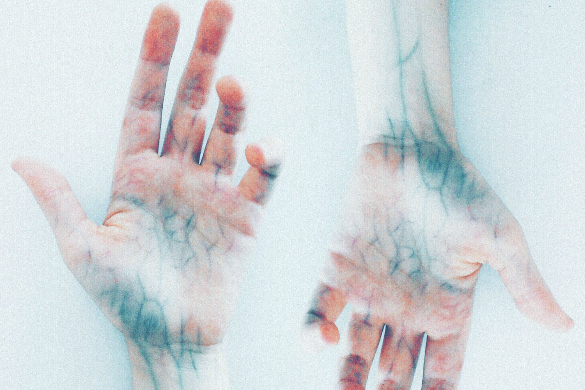 2 ruky, na ktorých vidieť modré žily