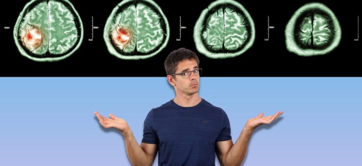 mozog zobrazený magnetickou rezonanciou
